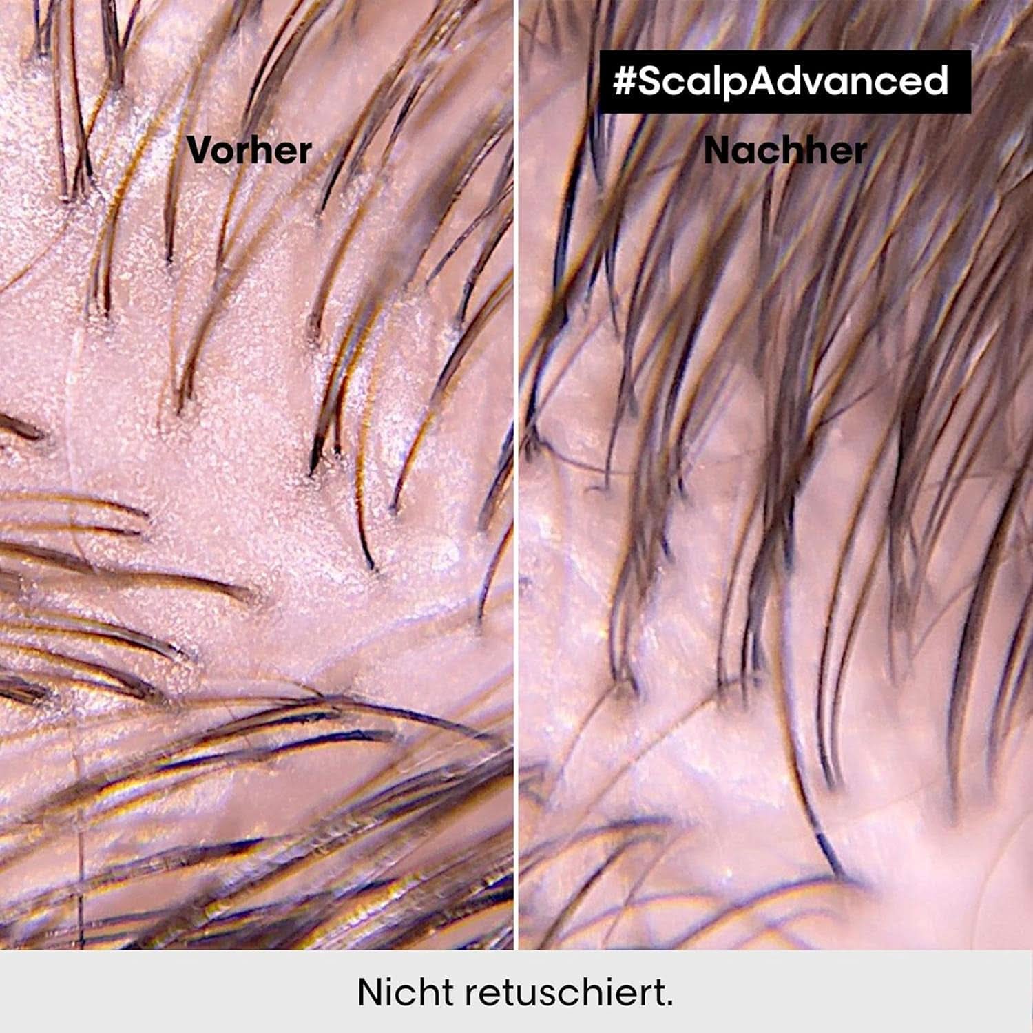 L'Oréal Professionnel Reinigungsshampoo für fettige Kopfhaut, 300 ml, Naty Shop Dusche und Bad