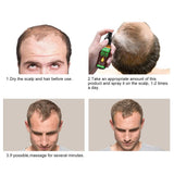 Haarwachstum, Anti-Haarausfall, Haarwachstumsspray, Haarausfall und Haarbehandlung, für dünner werdendes Haar, fördert dickeres, volleres und schnelleres Haarwachstum, 60 ml Haarpflege Naty Shop