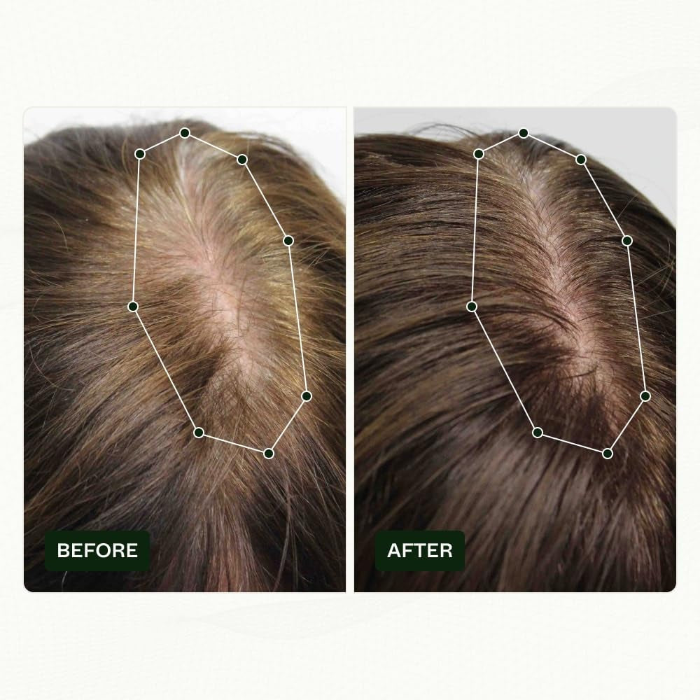 Haarwuchsroutine von Scandinavian Biolabs für Frauen mit klinisch nachgewiesenen Ergebnissen in 45 Tagen | Behandlung gegen Haarausfall (Bio-Pilixin) Naty Shop Haarpflege
