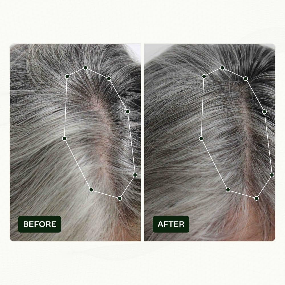 Haarwuchsroutine von Scandinavian Biolabs für Frauen mit klinisch nachgewiesenen Ergebnissen in 45 Tagen | Behandlung gegen Haarausfall (Bio-Pilixin) Naty Shop Haarpflege