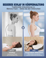 Nackenkissen Orthopädisches Kissen gegen Nackenschmerzen Memory-Schaum-Kissen Ergonomisches Kissen für optimale Unterstützung Nackenstützkissen für seitliche Rücken- und Bauchstützen Zervikale orthopädische Kissen Naty Shop
