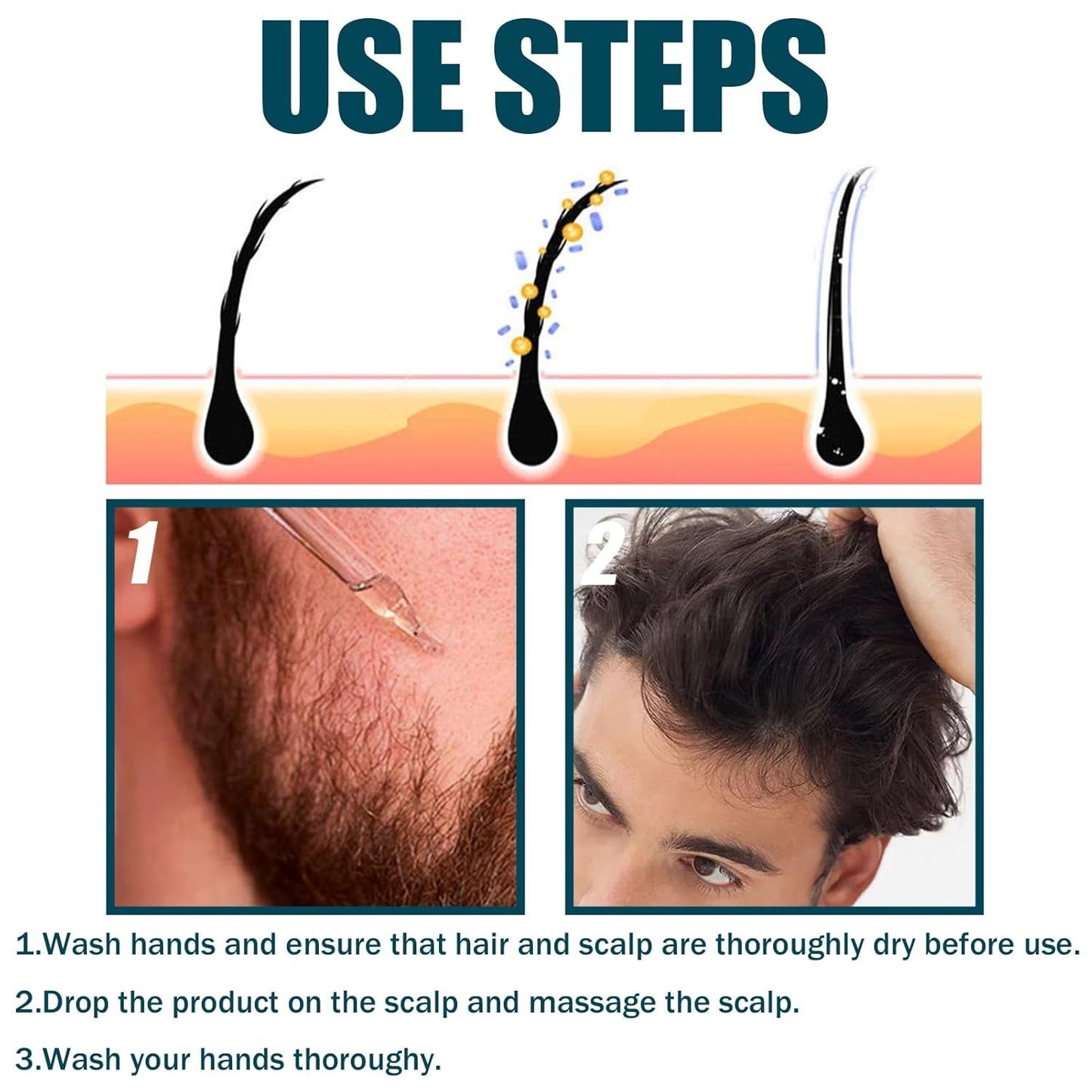 Miioto Haarwachstumsserum für Männer, Haarwachstumsprodukt, Haarwachstum, Haarserum, Kopfhautpflege, fördert dickeres Haar, nährt die Kopfhaut, verhindert Haarausfall, 3 x 60 ml, Haarpflege, Naty Shop