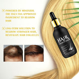Bio-Haarwachstumsöl 5 % – Lösung zur äußerlichen Anwendung – Haarwachstum und -verdichtung – Für männlichen Haarausfall und dünner werdendes Haar – Reaktiviert schrumpfende Follikel – Präziser Pumpspender, 60 ml Haarpflege Naty Shop