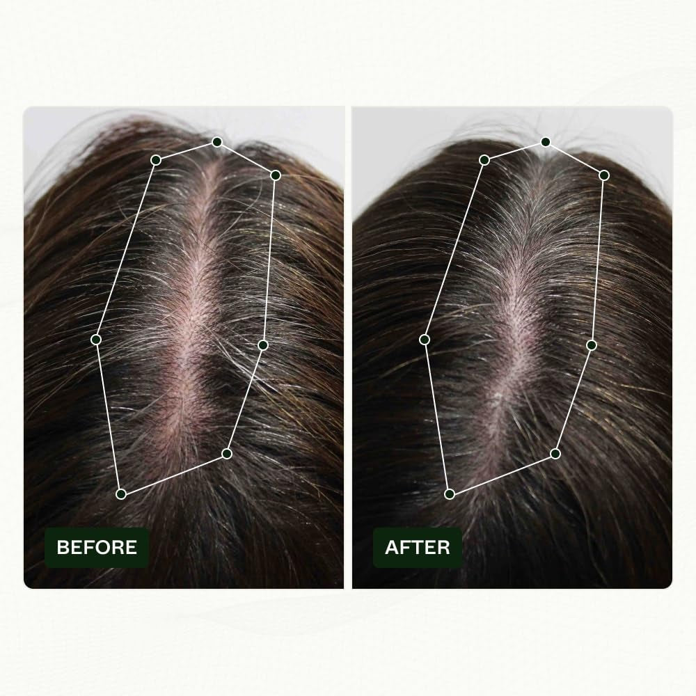 Haarwuchsroutine von Scandinavian Biolabs für Frauen mit klinisch nachgewiesenen Ergebnissen in 45 Tagen | Behandlung gegen Haarausfall (Bio-Pilixin) Naty Shop Haarpflege