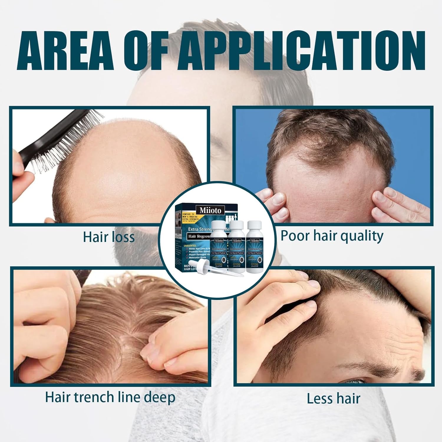 Miioto Haarwachstumsserum für Männer, Haarwachstumsprodukt, Haarwachstum, Haarserum, Kopfhautpflege, fördert dickeres Haar, nährt die Kopfhaut, verhindert Haarausfall, 3 x 60 ml, Haarpflege, Naty Shop